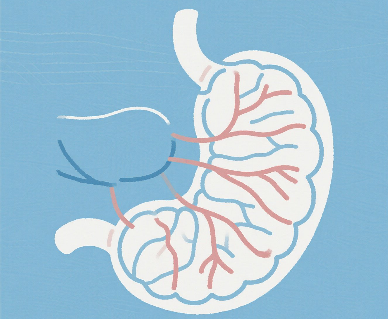 胃癌引起胃出血怎么办