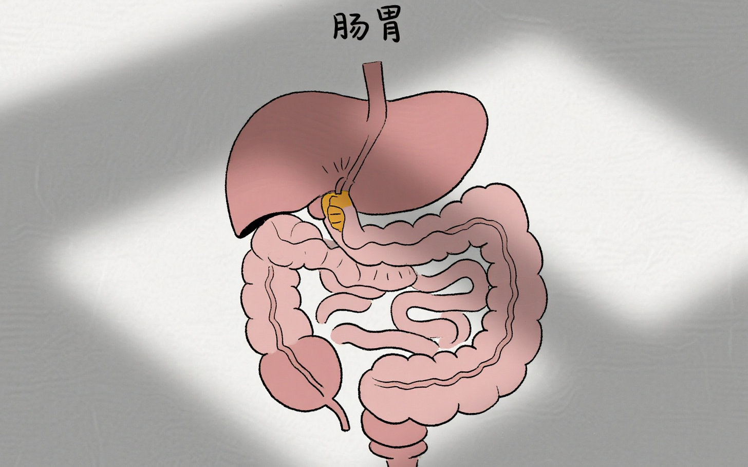 胃癌晚期该怎么办